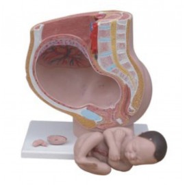 Coupe transversale du...